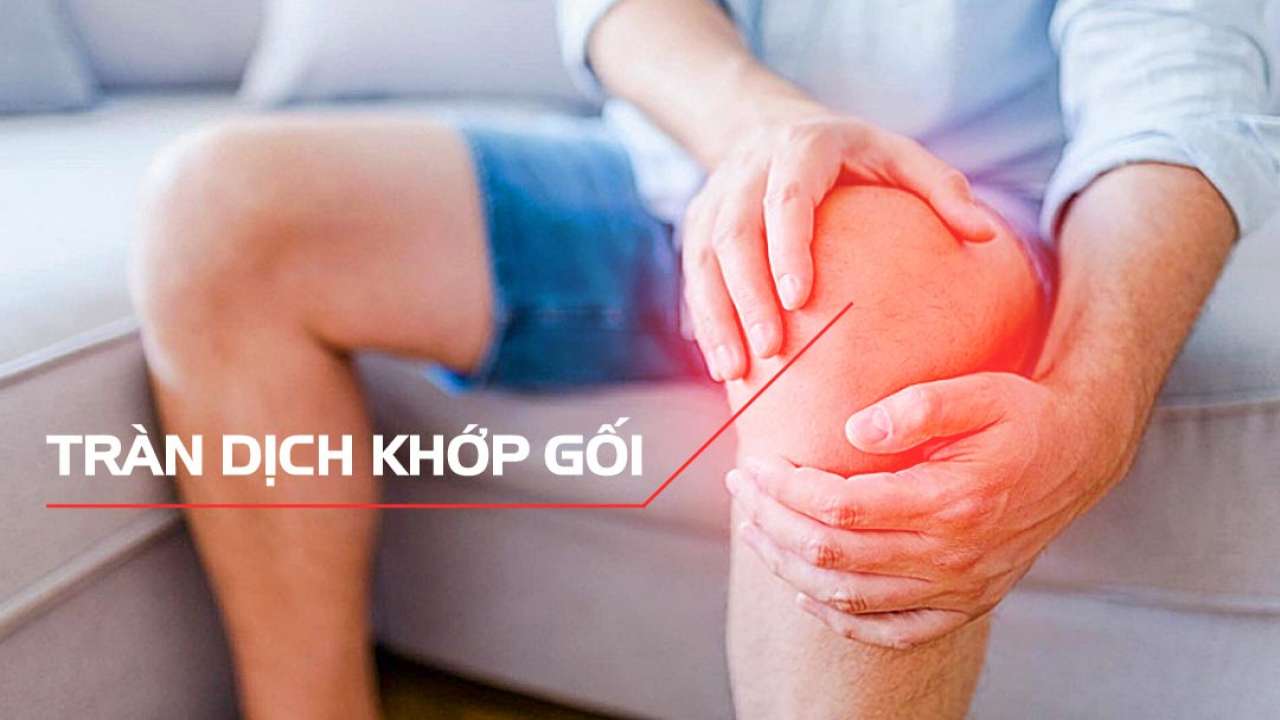 viem khop goi tran dich