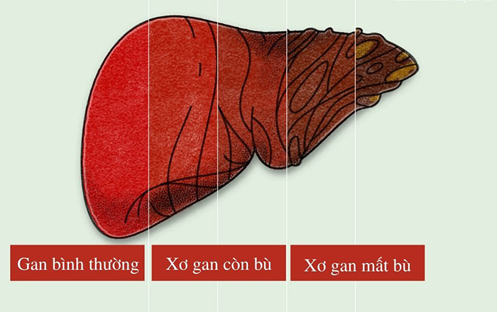 xo gan mat bu 16700699398111317621855