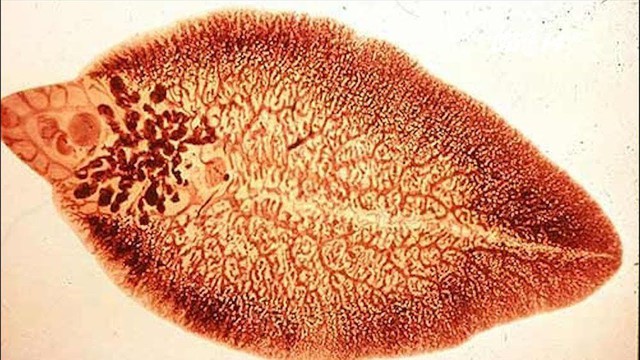 Nhiễm bệnh sán lá gan lớn do ăn rau sống