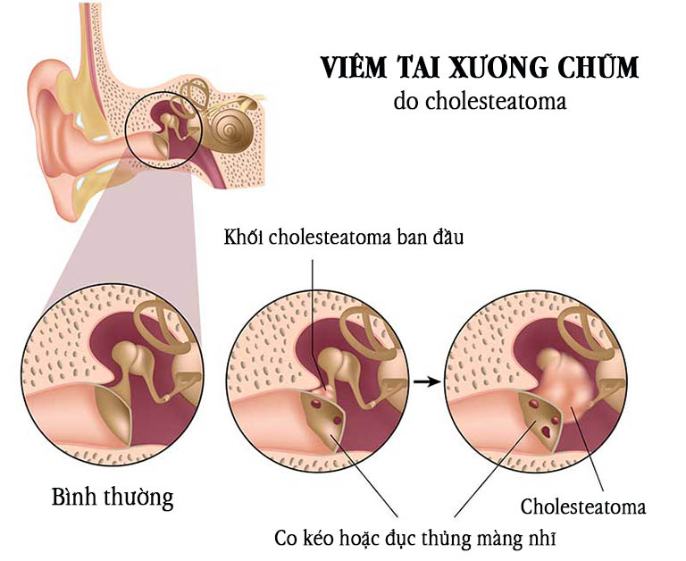 viem tai xuong chum1 1688562675979955546361