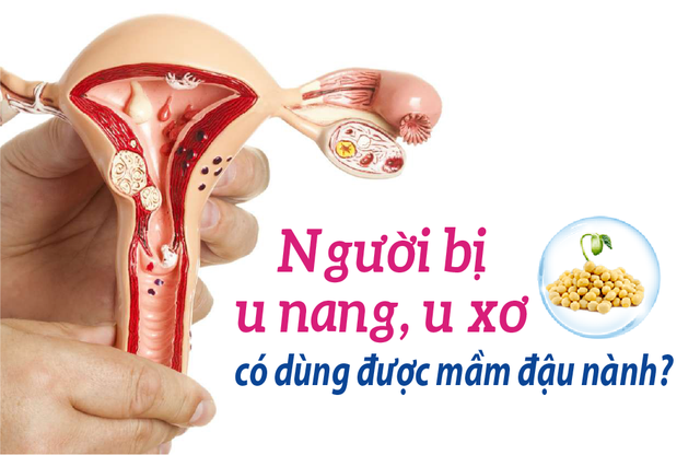 Người bi u nang, u sơ có dùng được mầm đậu nành?